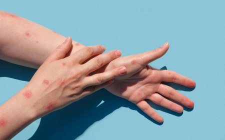 Ankara İl Sağlık Müdürlüğü "maymun çiçeği karantinası" iddialarını yalanladı